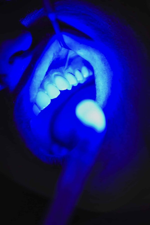 Les cliniques dentaires offrent-elles des services de dentisterie laser ?